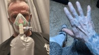 英国男子全身变蓝送去急救！医生一擦：床单掉色