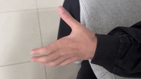 高中生左手莫名发抖确诊平山病 因长期保持错误坐姿