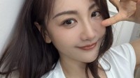 知名女演员杨蓉晒烫伤后疤痕恢复照：带疤的脸很酷