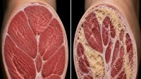 25岁vs55岁肌肉的真实差别:55岁像极雪花牛排